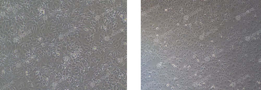 Hep 3B cells in normal status